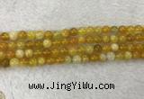 CAA1852 15.5 inches 8mm round banded agate gemstone beads