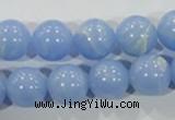 CTU1737 15.5 inches 16mm round synthetic turquoise beads